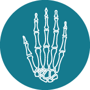 Carpometacarpal Surgery 