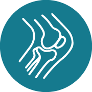 Partial Knee Replacement 