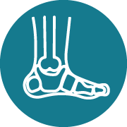 Total Ankle Replacement Surgery 