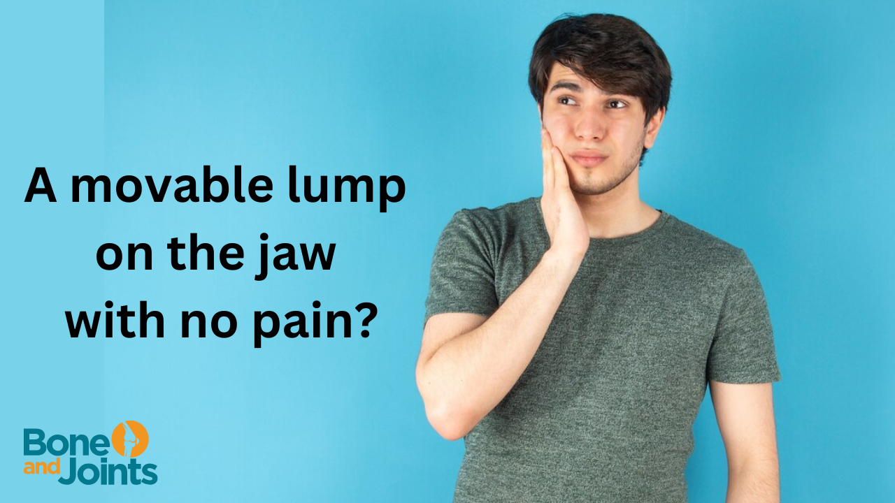 a movable lump on the jaw no pain 
