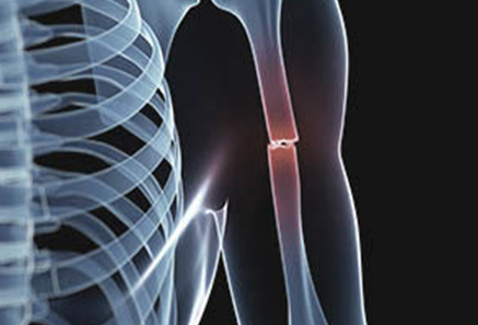 Fracture/Trauma Surgery