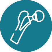 Total Hip Replacement 