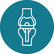 Total Knee Replacement 